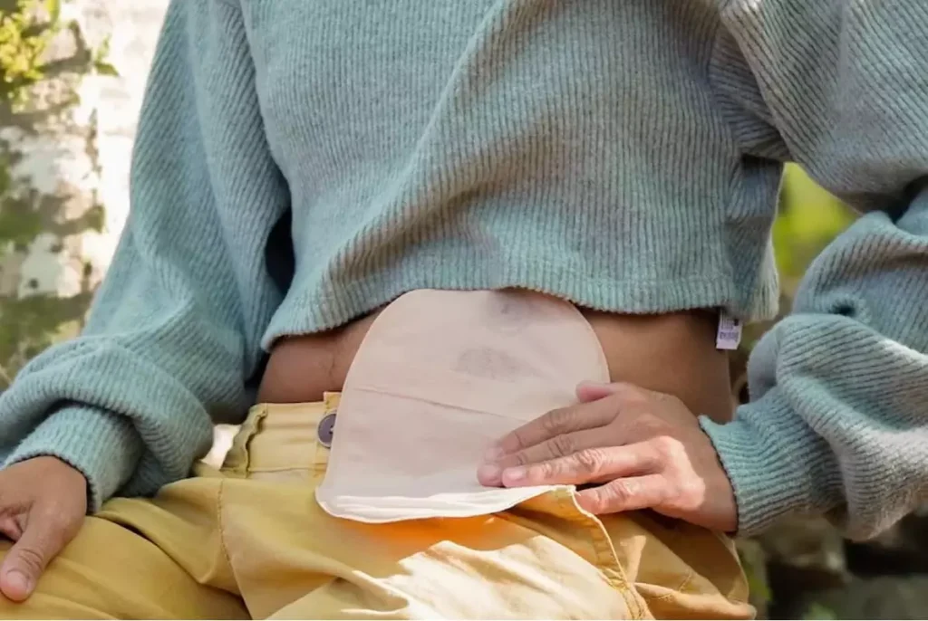 Daily life of patients with long-term chronic diseases