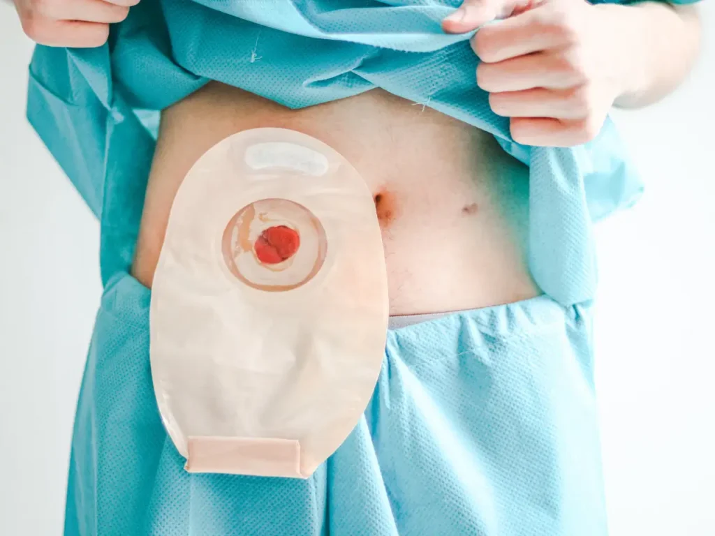 Hospital Post-Operative Rehabilitation