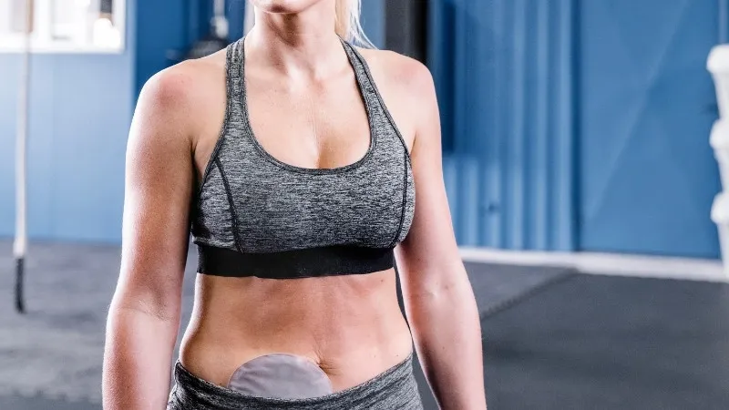 Postoperative rehabilitation population